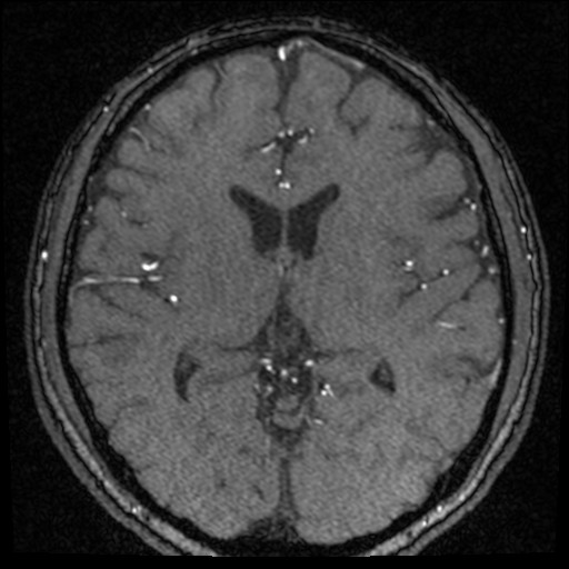 Click on the Serie image to view the images of VILLANUEVA, WILLIAM A.